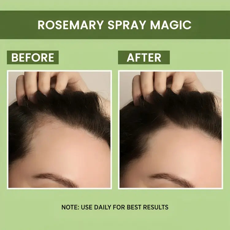 <p>Rosemary Water, Hair Spray For Regrowth </p> <p style="font-size: 15px; line-height: 1.5;">   Free Cash on Delivery 3 - 5 Days <br>   5k+ Sold last month <br> ⭐️⭐️⭐️⭐️⭐️4.8/5 (12,600+ REVIEWS) <br>🔥 BUY 1 GET 1 FREE🔥</p