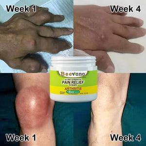 Bee Venom Joint and Bone Therapy Cream ⭐️⭐️⭐️⭐️⭐️4.8/5 (12,600+ REVIEWS)