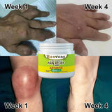 Bee Venom Joint and Bone Therapy Cream ⭐️⭐️⭐️⭐️⭐️4.8/5 (12,600+ REVIEWS)