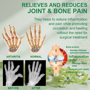 Bee Venom Joint and Bone Therapy Cream ⭐️⭐️⭐️⭐️⭐️4.8/5 (12,600+ REVIEWS)